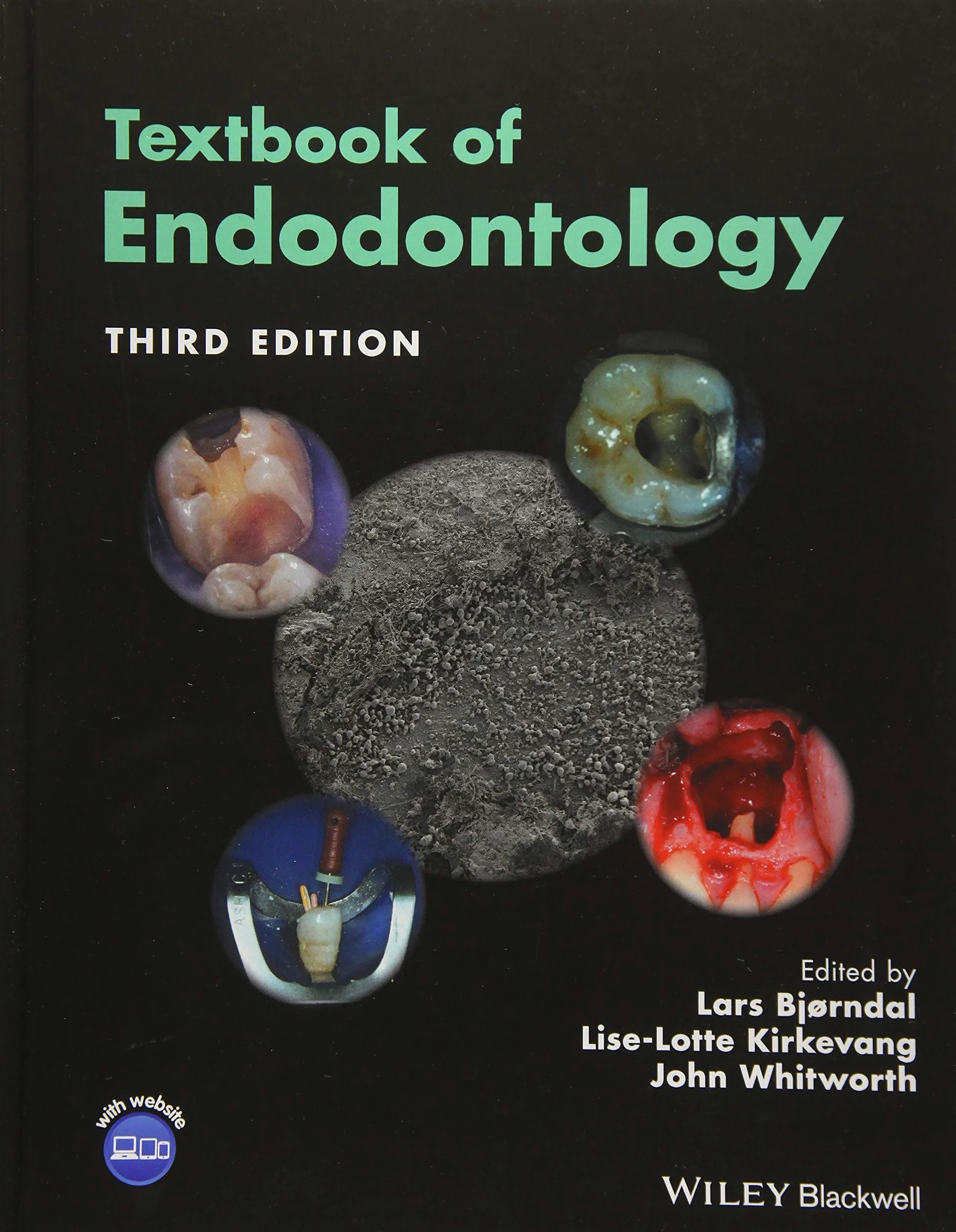 Textbook of Endodontology