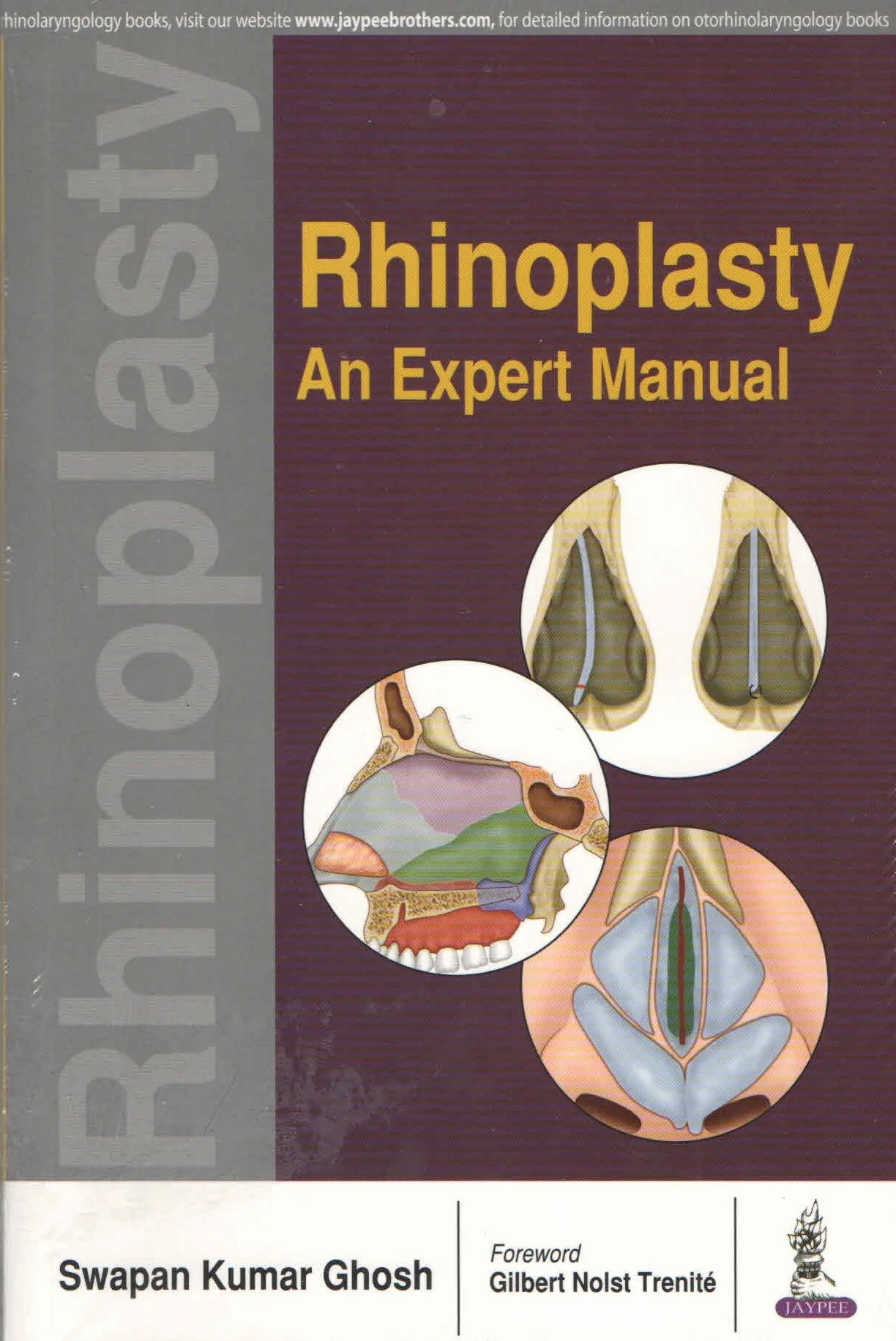 Rhinoplasty: An Expert Manual