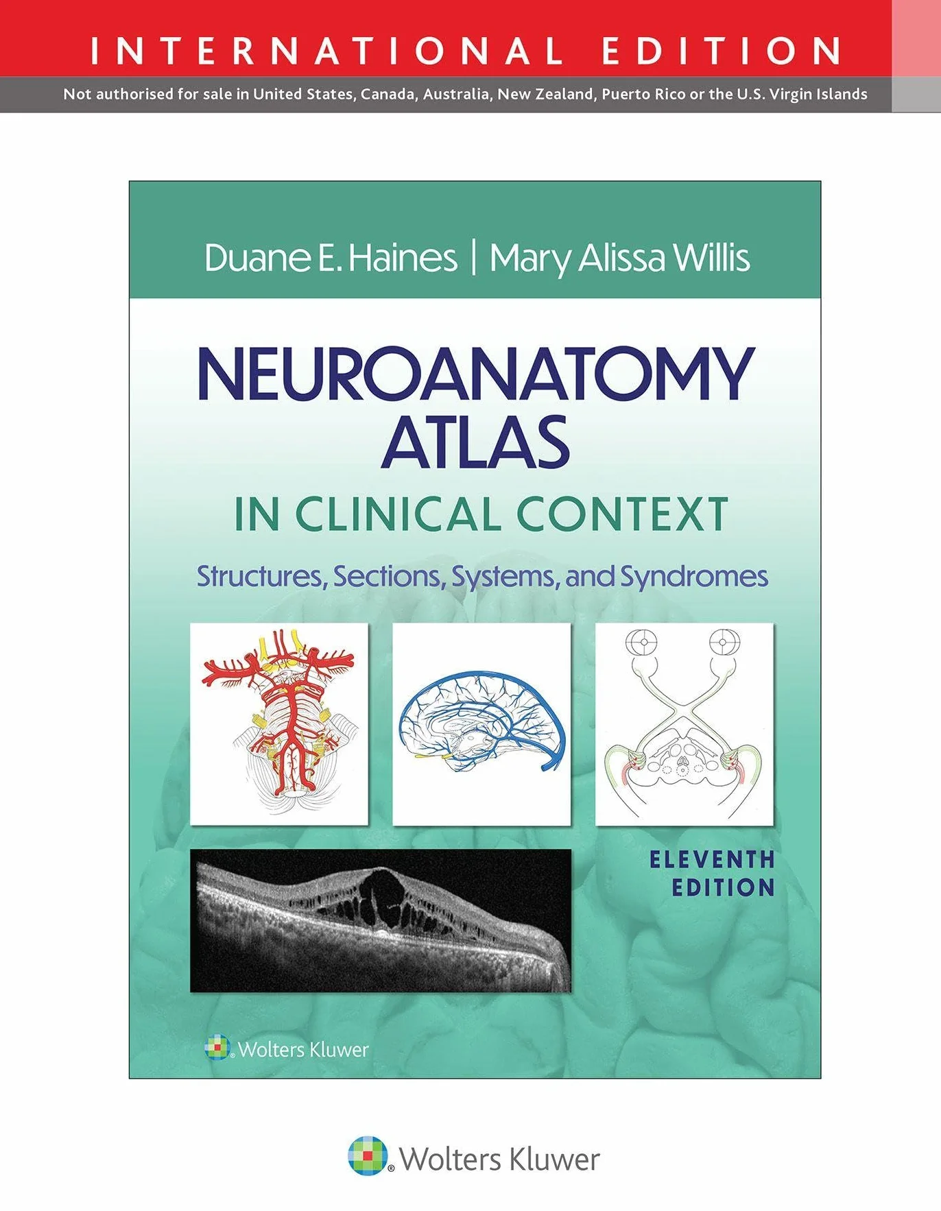 Neuroanatomy Atlas in Clinical Context: Structures, Sections, Systems, and Syndromes