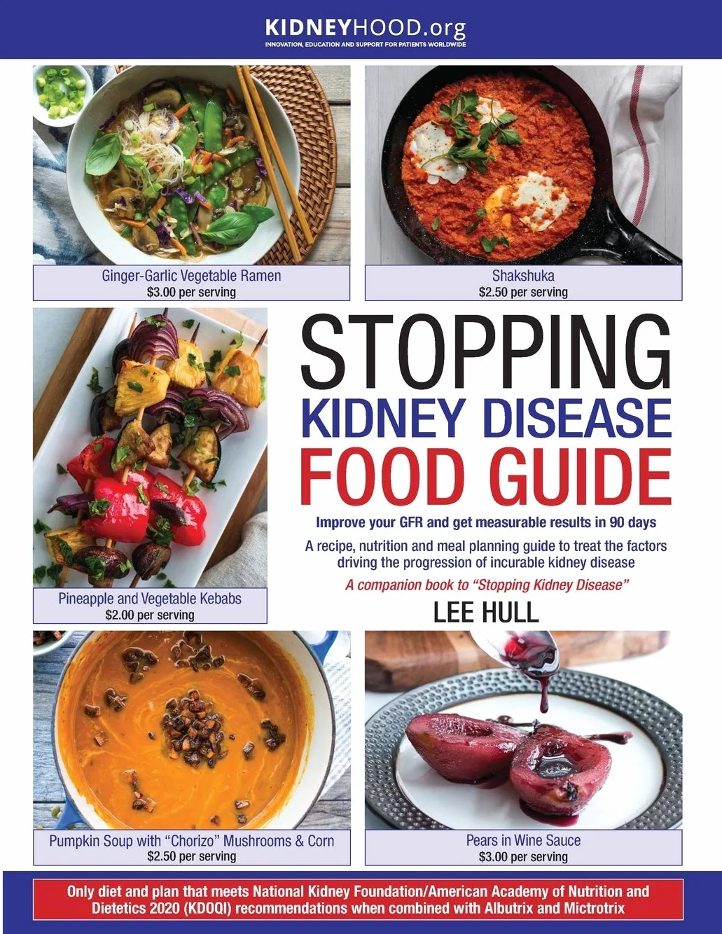 Stopping Kidney Disease Food Guide: A recipe, nutrition and meal planning guide to treat the factors driving the progression of incurable kidney disease