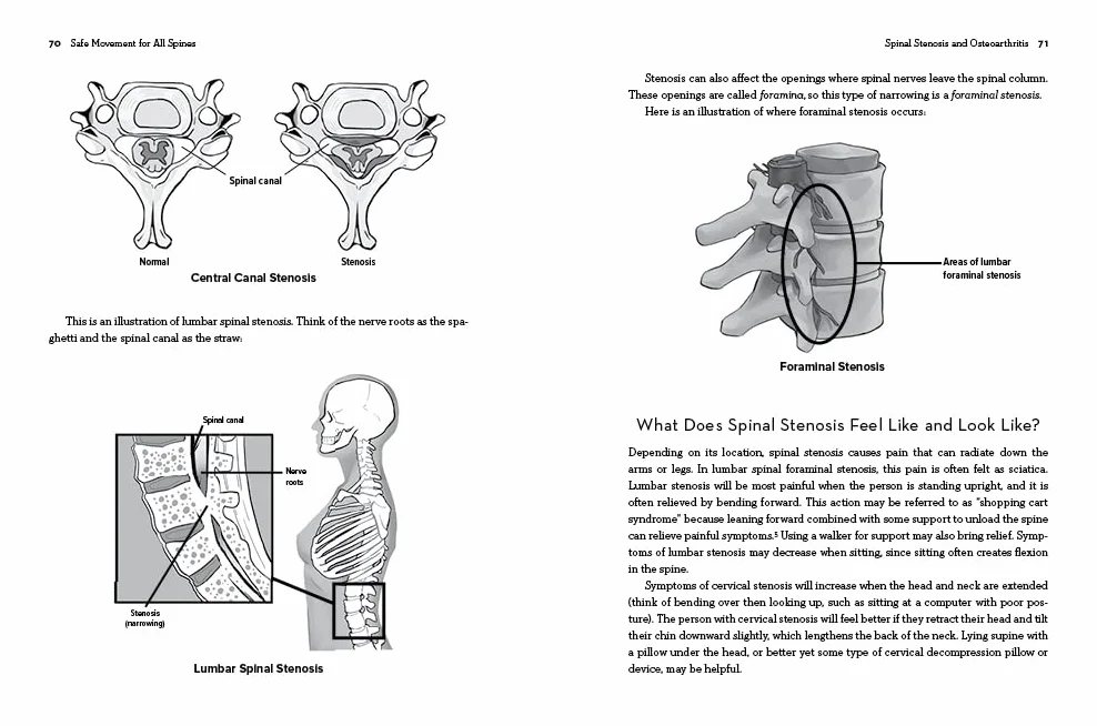 Safe Movement for All Spines: A Guide to Spinal Anatomy and How to Work with 21 Spine and Hip Conditions