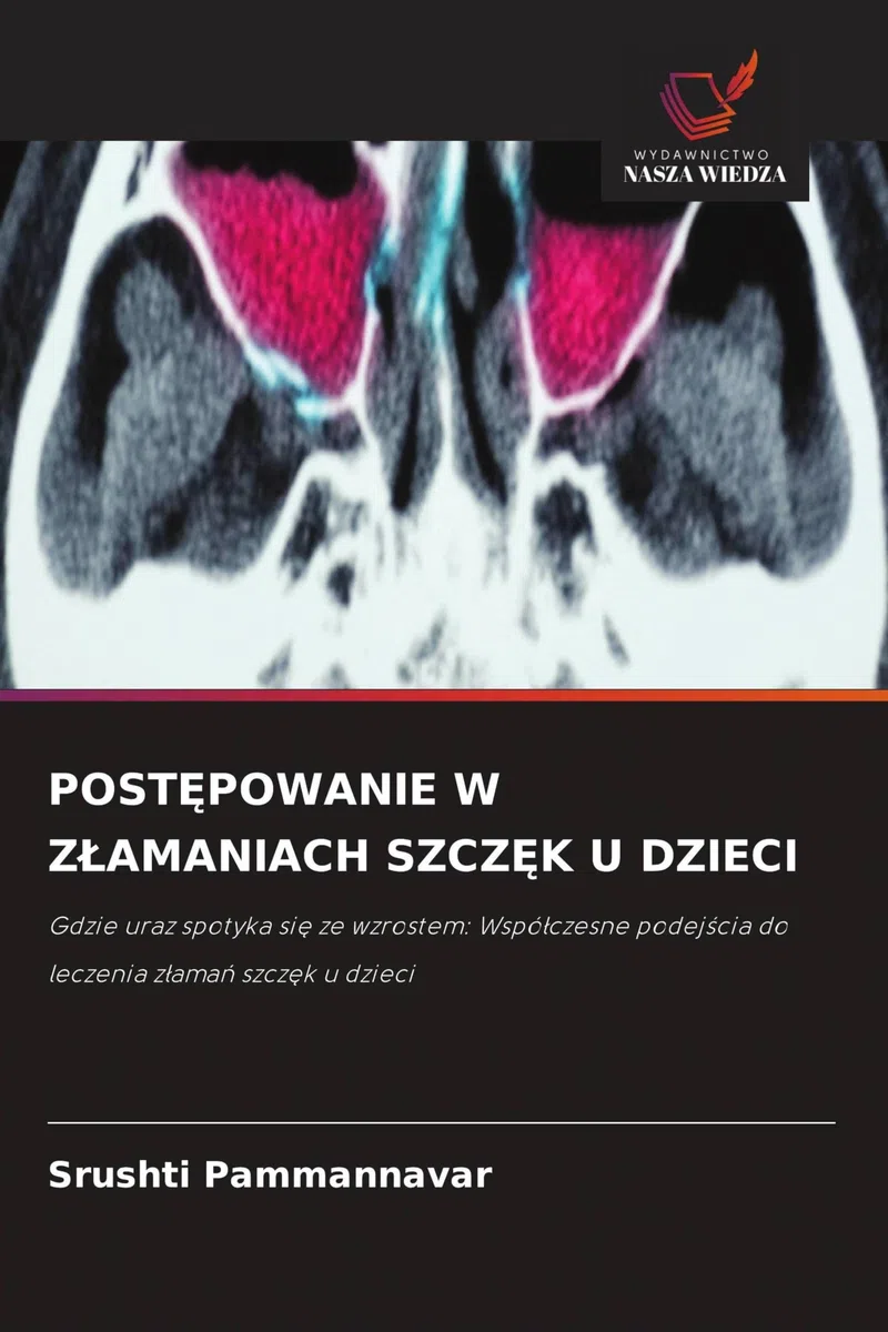 POST¿POWANIE W Z¿AMANIACH SZCZ¿K U DZIECI: Gdzie uraz spotyka si¿ ze wzrostem: Wspó¿czesne podej¿cia do leczenia z¿ama¿ szcz¿k u dzieci