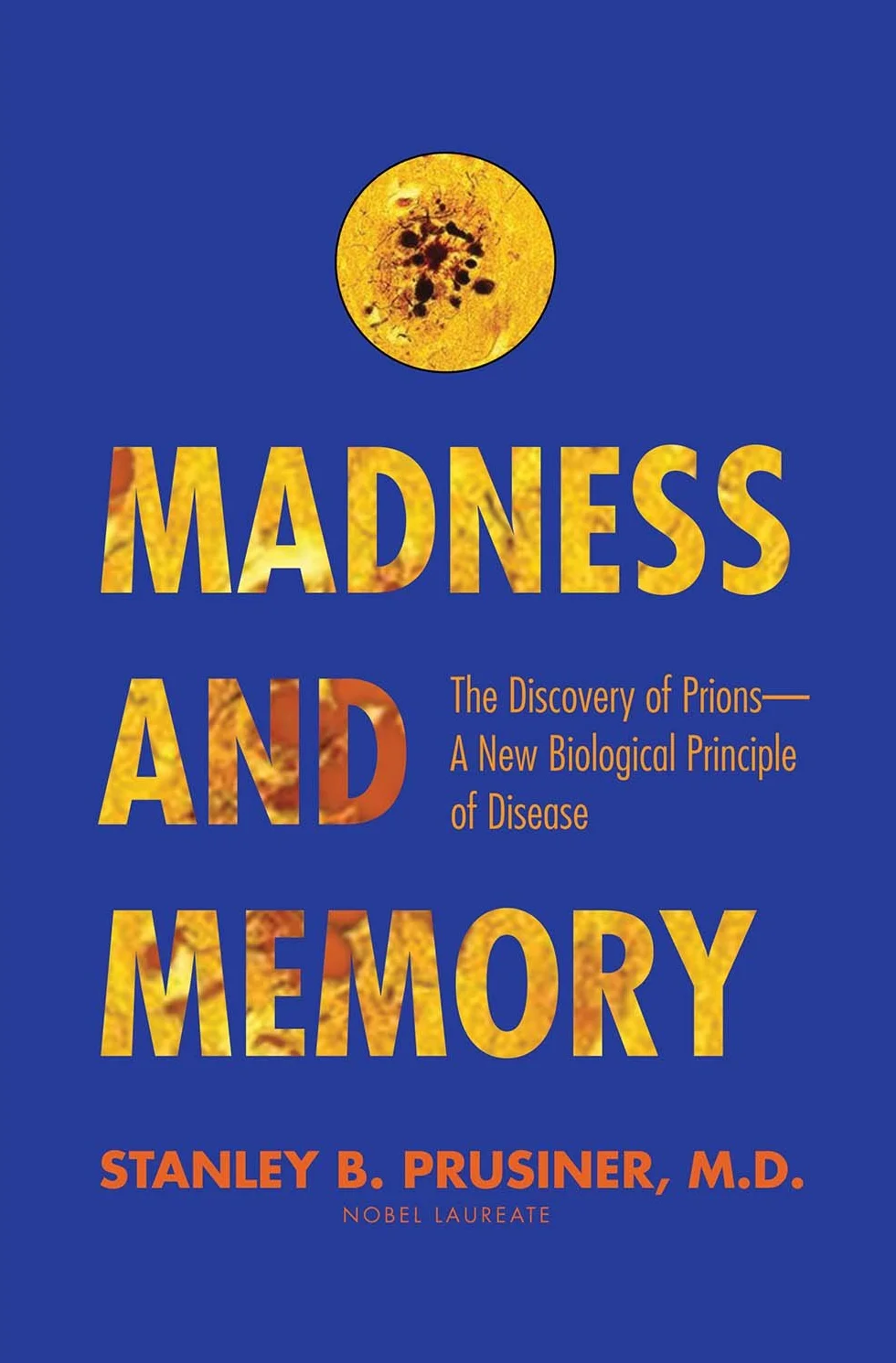 Madness and Memory: The Discovery of Prions--A New Biological Principle of Disease
